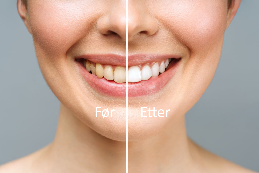 PAP+ Whitening Tannblekestrimler